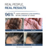 Anti-Hair Fall Shampoo With Adenosine & Peptides for Hair Fall Control - 250 ml