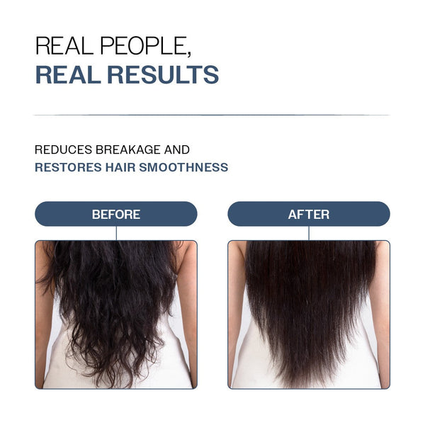 Hair Fall Control Duo | Anti-Hair Fall Shampoo 250 ml & Conditioner 175 gm